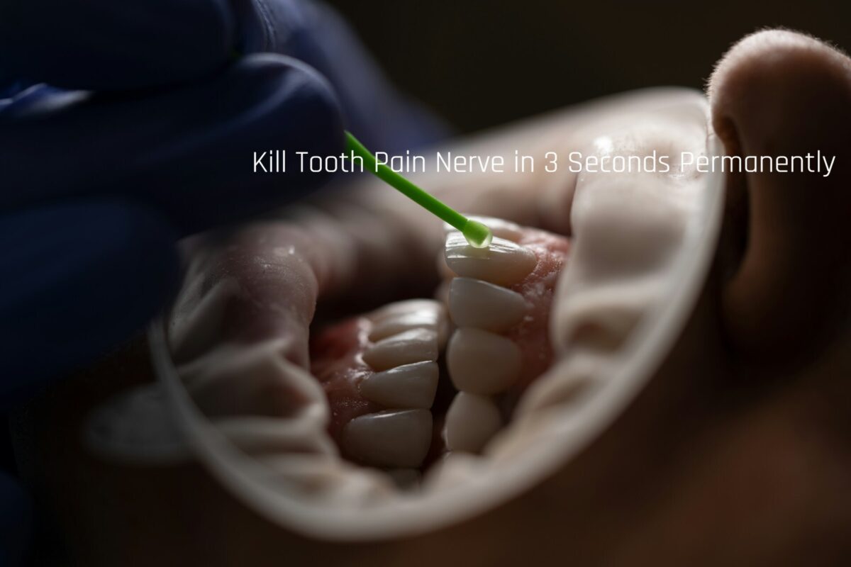 Kill Tooth Pain Nerve in 3 Seconds Permanently